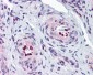 IL33 Antibody (Internal)